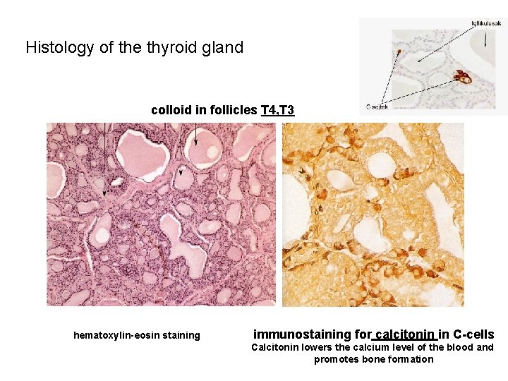 Histology of the thyroid gland colloid in follicles T 4, T 3 hematoxylin-eosin staining