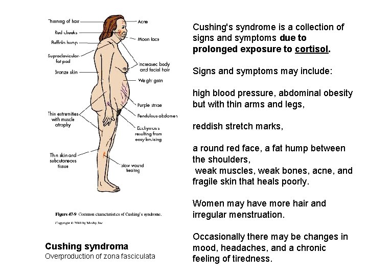 Cushing's syndrome is a collection of signs and symptoms due to prolonged exposure to