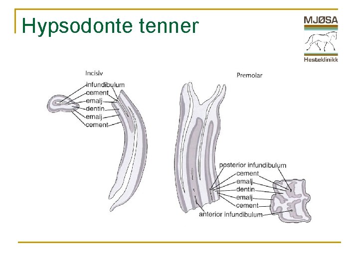 Hypsodonte tenner 