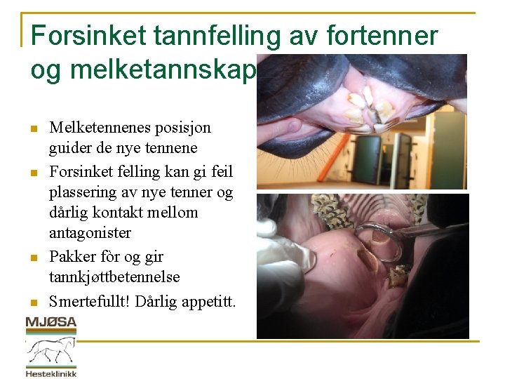 Forsinket tannfelling av fortenner og melketannskapper n n Melketennenes posisjon guider de nye tennene