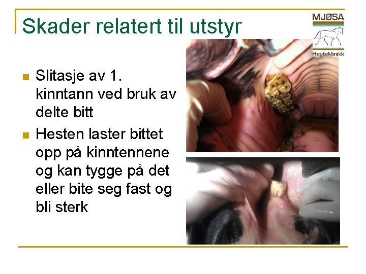 Skader relatert til utstyr n n Slitasje av 1. kinntann ved bruk av delte