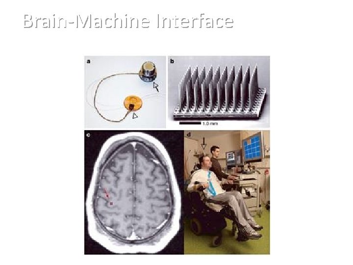 Brain-Machine Interface Braingate Neural Interface System 