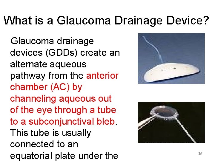 What is a Glaucoma Drainage Device? Glaucoma drainage devices (GDDs) create an alternate aqueous