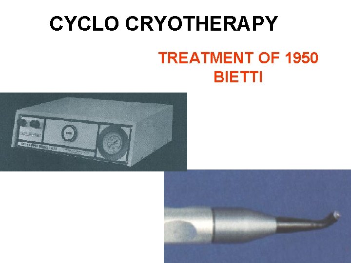 CYCLO CRYOTHERAPY TREATMENT OF 1950 BIETTI 