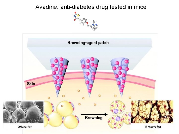 Avadine: anti-diabetes drug tested in mice 