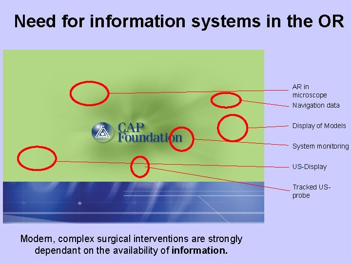 Need for information systems in the OR AR in microscope Navigation data Display of