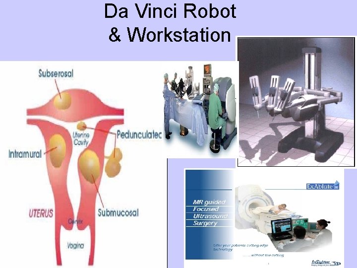 Da Vinci Robot & Workstation 