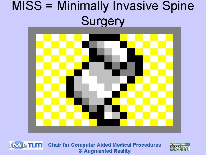 MISS = Minimally Invasive Spine Surgery Chair for Computer Aided Medical Procedures & Augmented