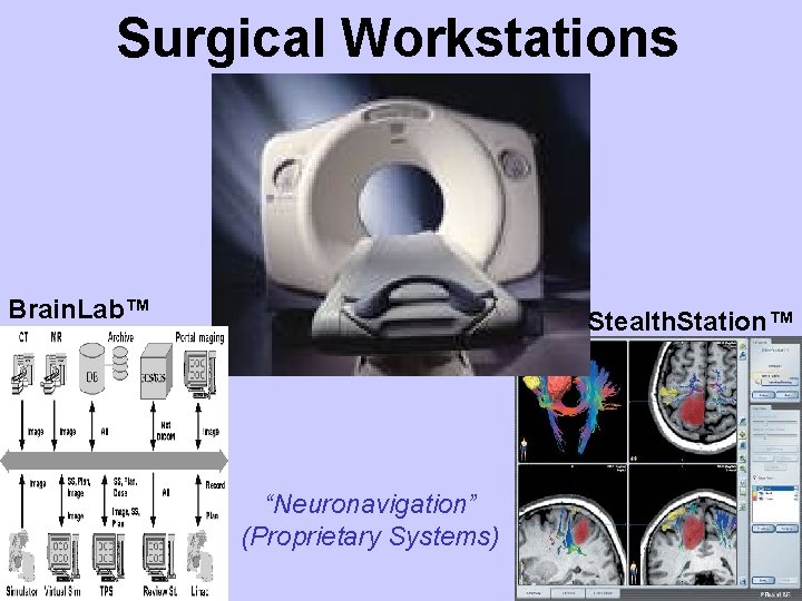 Surgical Workstations Brain. Lab™ Stealth. Station™ “Neuronavigation” (Proprietary Systems) 