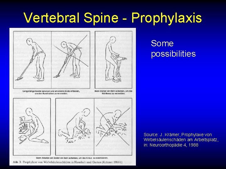 Vertebral Spine - Prophylaxis Some possibilities Source: J. Krämer, Prophylaxe von Wirbelsäulenschäden am Arbeitsplatz,