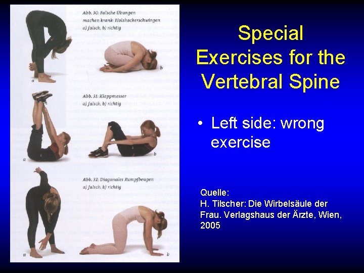 Special Exercises for the Vertebral Spine • Left side: wrong exercise Quelle: H. Tilscher: