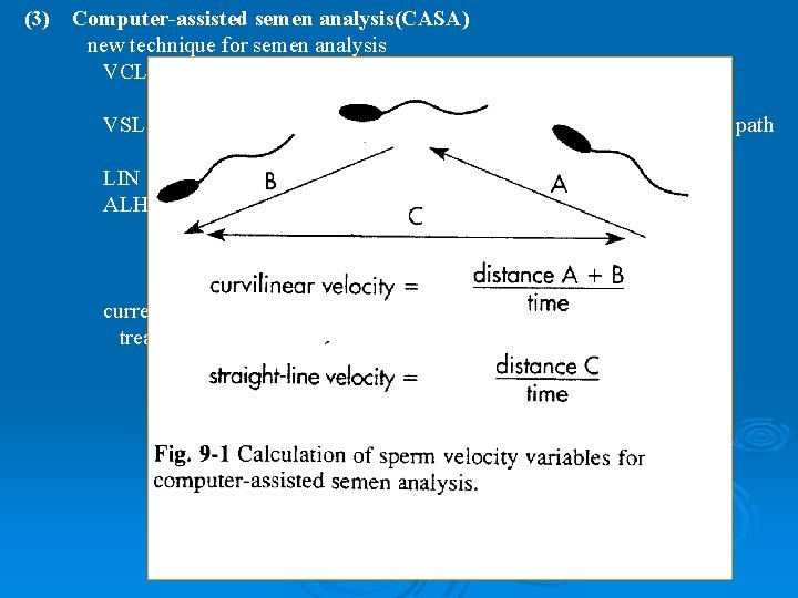 (3) Computer-assisted semen analysis(CASA) new technique for semen analysis VCL (curvilinear velocity): average distance