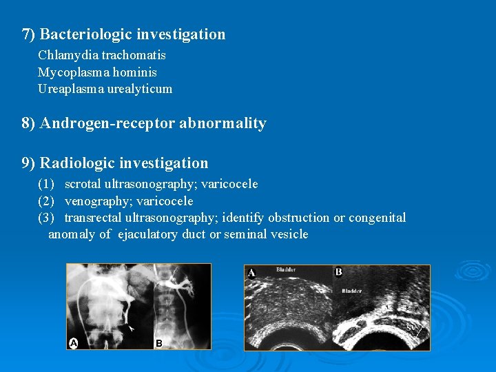 7) Bacteriologic investigation Chlamydia trachomatis Mycoplasma hominis Ureaplasma urealyticum 8) Androgen-receptor abnormality 9) Radiologic