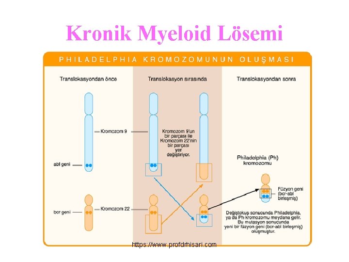 Kronik Myeloid Lösemi https: //www. profdrhisari. com 