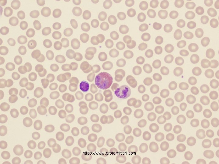 https: //www. profdrhisari. com 