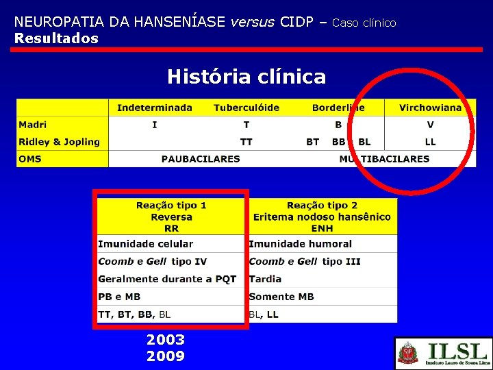 NEUROPATIA DA HANSENÍASE versus CIDP – Resultados História clínica 2003 2009 Caso clínico 