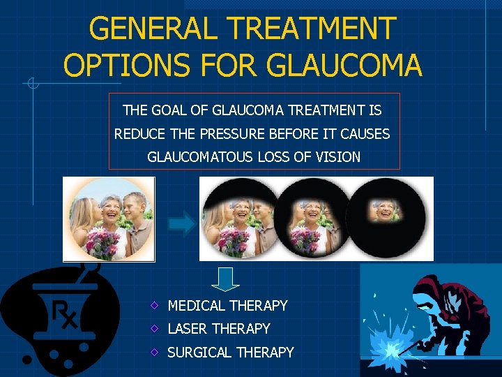 GENERAL TREATMENT OPTIONS FOR GLAUCOMA THE GOAL OF GLAUCOMA TREATMENT IS REDUCE THE PRESSURE