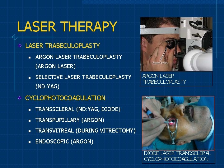 LASER THERAPY LASER TRABECULOPLASTY n ARGON LASER TRABECULOPLASTY (ARGON LASER) n SELECTIVE LASER TRABECULOPLASTY