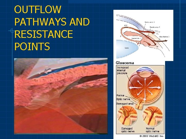 OUTFLOW PATHWAYS AND RESISTANCE POINTS 