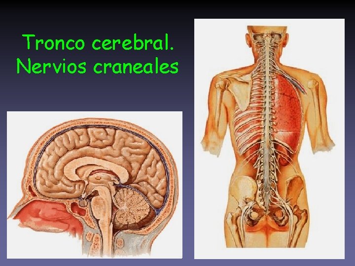Tronco cerebral. Nervios craneales 