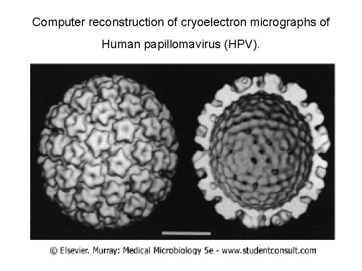 Computer reconstruction of cryoelectron micrographs of Human papillomavirus (HPV). 