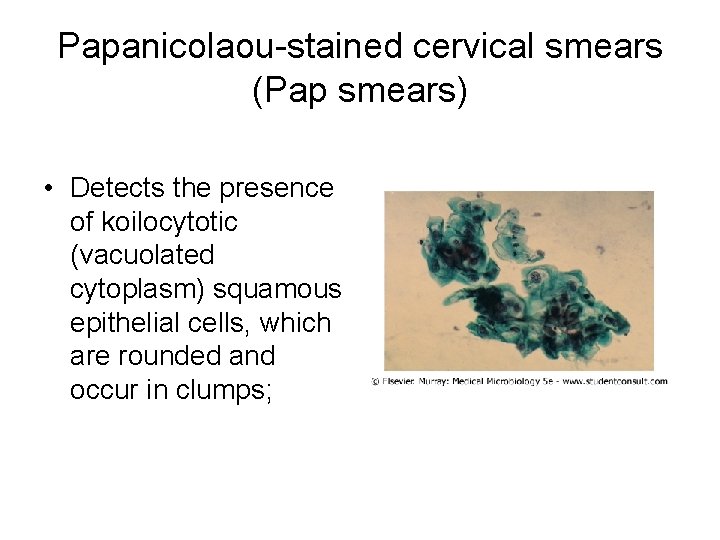 Papanicolaou-stained cervical smears (Pap smears) • Detects the presence of koilocytotic (vacuolated cytoplasm) squamous