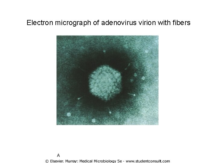 Electron micrograph of adenovirus virion with fibers 