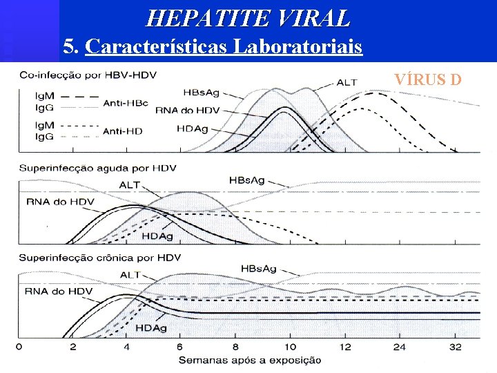 HEPATITE VIRAL 5. Características Laboratoriais VÍRUS D 
