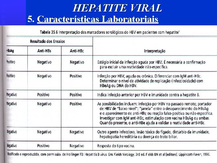 HEPATITE VIRAL 5. Características Laboratoriais 