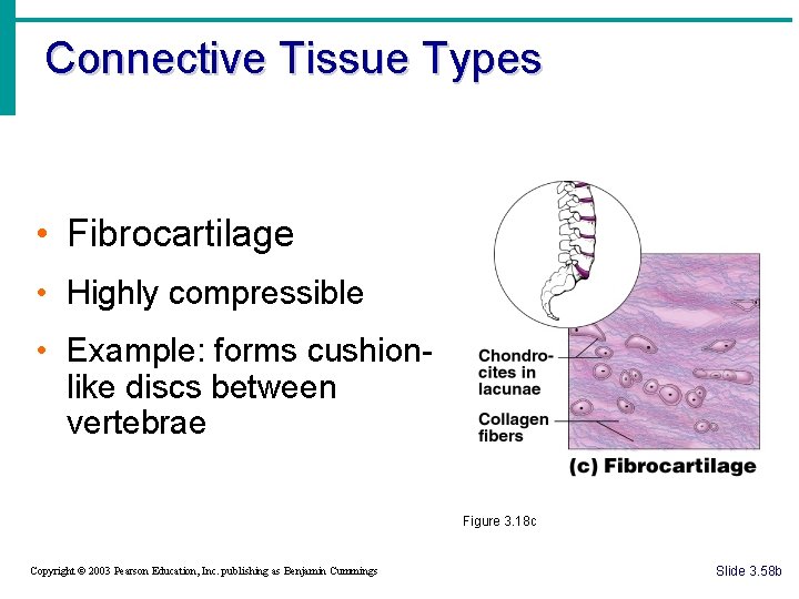 Connective Tissue Types • Fibrocartilage • Highly compressible • Example: forms cushionlike discs between