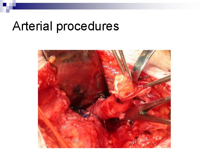 Arterial procedures 