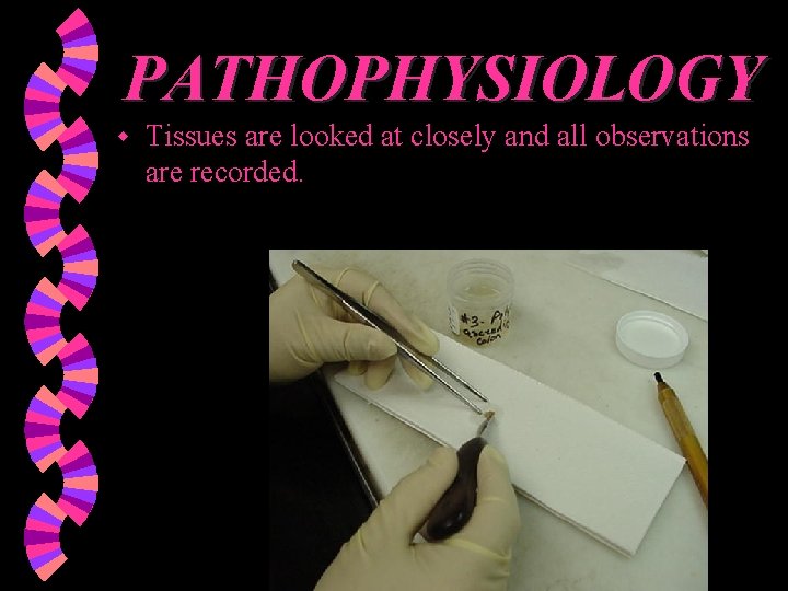 PATHOPHYSIOLOGY w Tissues are looked at closely and all observations are recorded. 
