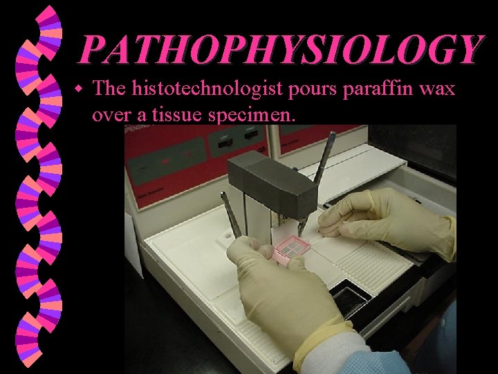 PATHOPHYSIOLOGY w The histotechnologist pours paraffin wax over a tissue specimen. 