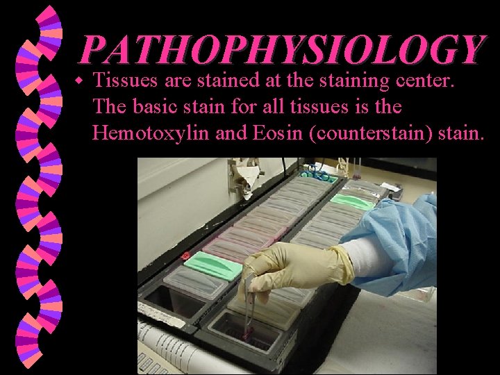 PATHOPHYSIOLOGY w Tissues are stained at the staining center. The basic stain for all