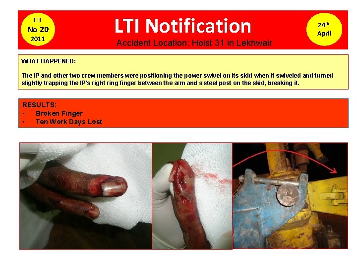 LTI No 20 2011 LTI Notification 24 th April Accident Location: Hoist 31 in