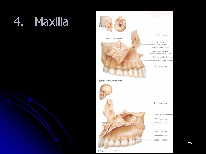 4. Maxilla 24/9 4. Maxilla 24/9