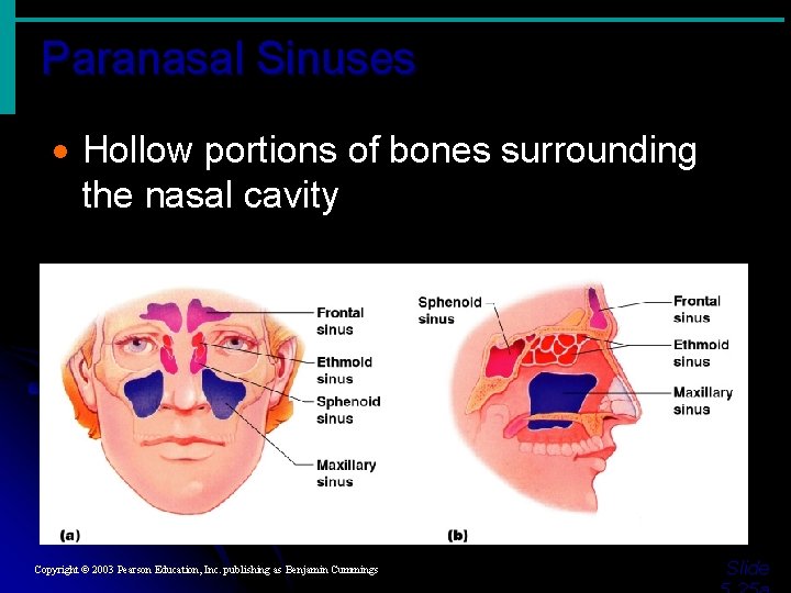Paranasal Sinuses · Hollow portions of bones surrounding the nasal cavity Figure 5. 10 Paranasal Sinuses · Hollow portions of bones surrounding the nasal cavity Figure 5. 10