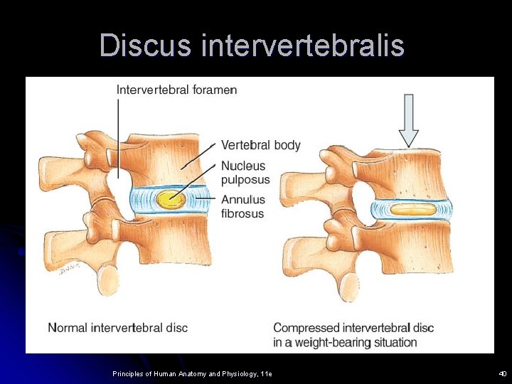 Discus intervertebralis Principles of Human Anatomy and Physiology, 11 e 40 Discus intervertebralis Principles of Human Anatomy and Physiology, 11 e 40