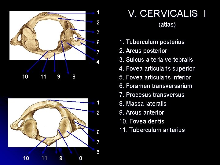 1 V. CERVICALIS I 2 (atlas) 3 6 7 4 10 11 9 8 1 V. CERVICALIS I 2 (atlas) 3 6 7 4 10 11 9 8