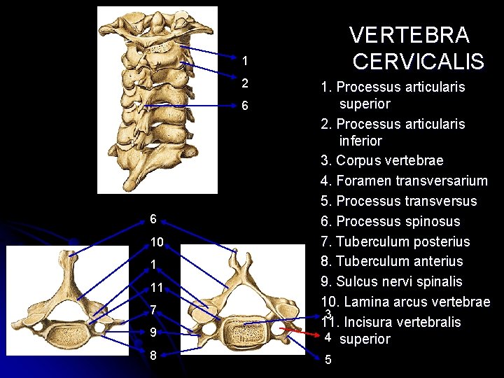 VERTEBRA CERVICALIS 1 2 6 6 10 1 11 7 9 8 1. Processus VERTEBRA CERVICALIS 1 2 6 6 10 1 11 7 9 8 1. Processus