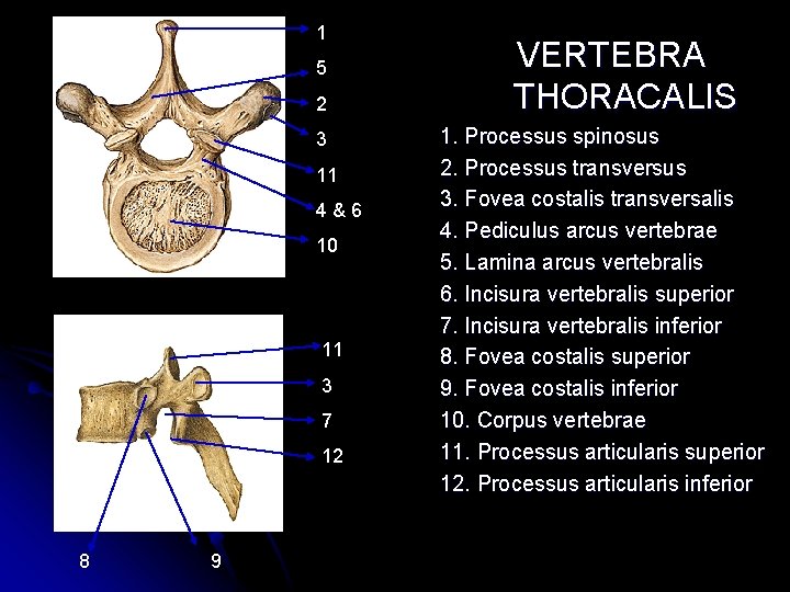 1 5 2 3 11 4&6 10 11 3 7 12 8 9 VERTEBRA 1 5 2 3 11 4&6 10 11 3 7 12 8 9 VERTEBRA