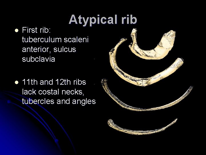 Atypical rib l First rib: tuberculum scaleni anterior, sulcus subclavia l 11 th and Atypical rib l First rib: tuberculum scaleni anterior, sulcus subclavia l 11 th and