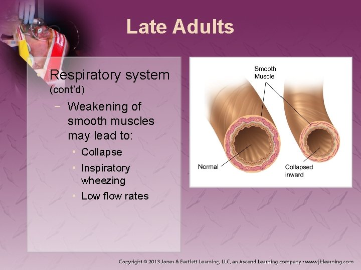 Late Adults • Respiratory system (cont’d) − Weakening of smooth muscles may lead to: Late Adults • Respiratory system (cont’d) − Weakening of smooth muscles may lead to: