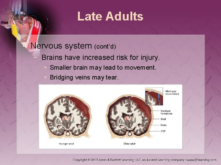Late Adults • Nervous system (cont’d) − Brains have increased risk for injury. • Late Adults • Nervous system (cont’d) − Brains have increased risk for injury. •