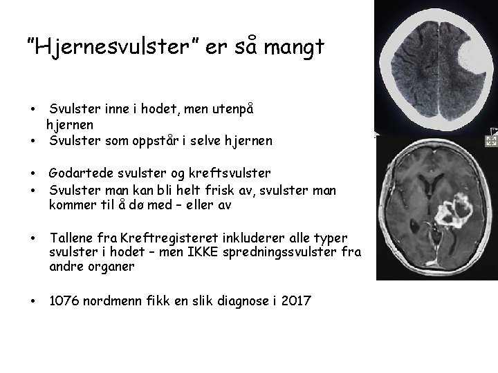 ”Hjernesvulster” er så mangt Svulster inne i hodet, men utenpå hjernen • Svulster som