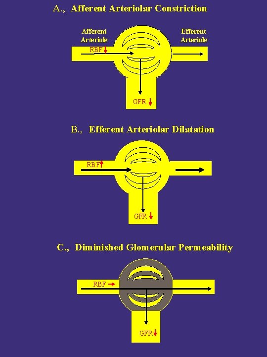 A. , Afferent Arteriolar Constriction Afferent Arteriole RBF Efferent Arteriole GFR B. , Efferent