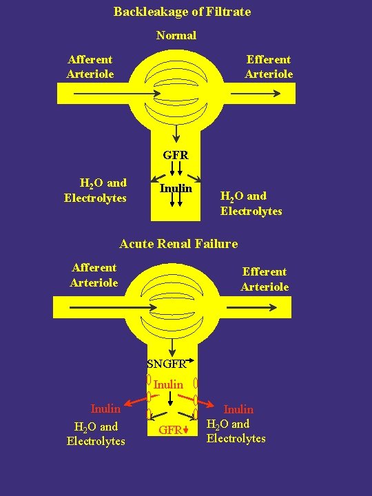 Backleakage of Filtrate Normal Afferent Arteriole Efferent Arteriole GFR H 2 O and Electrolytes Backleakage of Filtrate Normal Afferent Arteriole Efferent Arteriole GFR H 2 O and Electrolytes