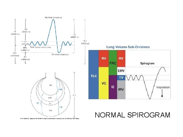 NORMAL SPIROGRAM 