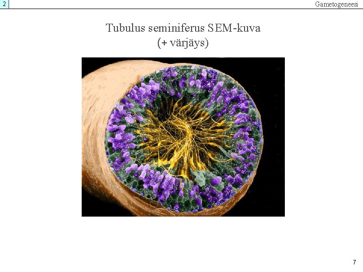 Gametogeneesi 2 Tubulus seminiferus SEM-kuva (+ värjäys) 7 Gametogeneesi 2 Tubulus seminiferus SEM-kuva (+ värjäys) 7