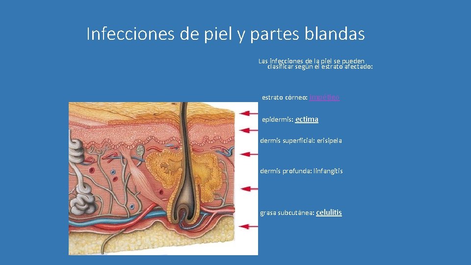 Infecciones de piel y partes blandas Las infecciones de la piel se pueden clasificar